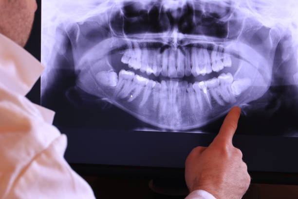 Best Emergency Dental Care for Sports Injuries in Burgin, KY